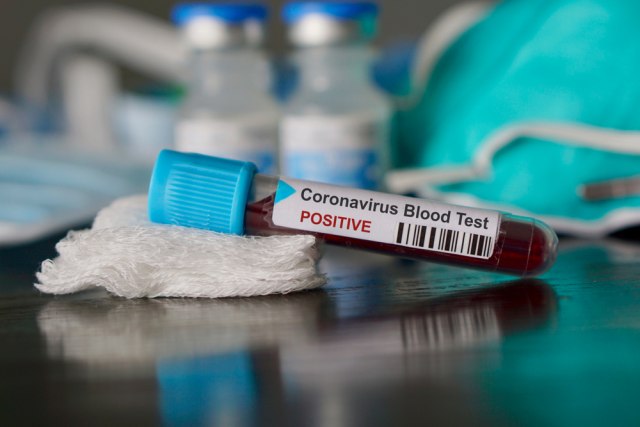 Broj obolelih od koronavirusa ponovo raste: 
